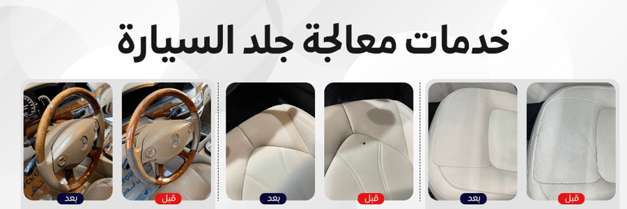 معالجة حرق الجلد - عنوان العزل